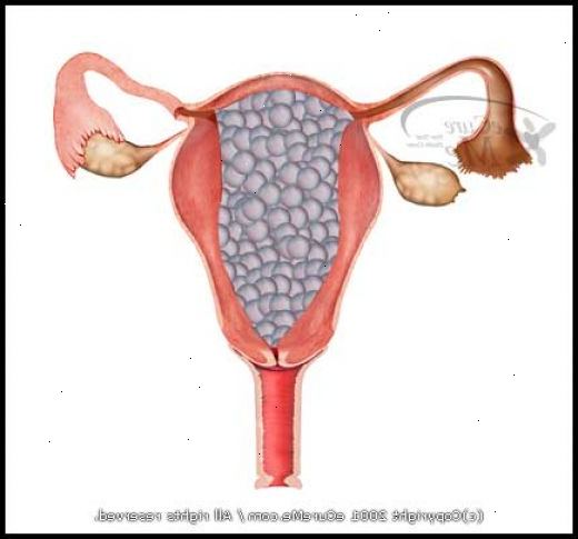 Molar graviditet