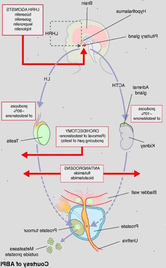 Hormonbehandling för prostatacancer